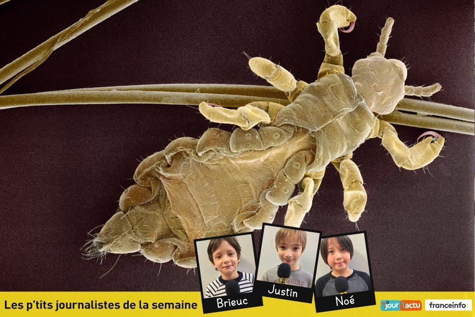 Les poux à l'attaque ! Les poux à l'attaque !